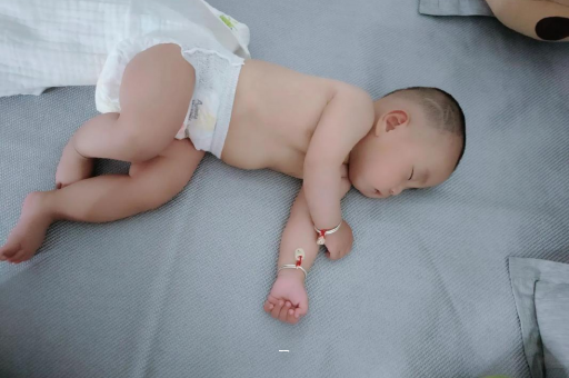 桂阳宝宝脸上有白色斑块